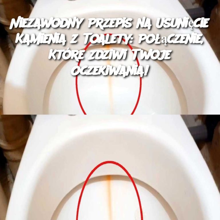 Niezawodny Przepis na Usunięcie Kamienia z Toalety: Połączenie, Które Zdziwi Twoje Oczekiwania!