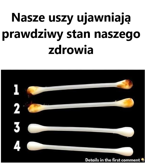 Nasze Uszy Ujawniają Prawdziwy Stan Naszego Zdrowia