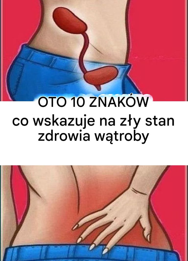 10 Znaków, Co Wskazuje na Zły Stan Zdrowia Wątroby