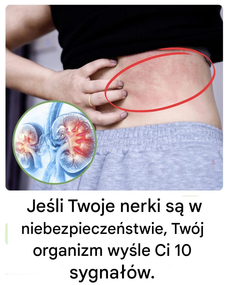 10 Znaków, Że Twoje Nerki Mogą Być w Niebezpieczeństwie