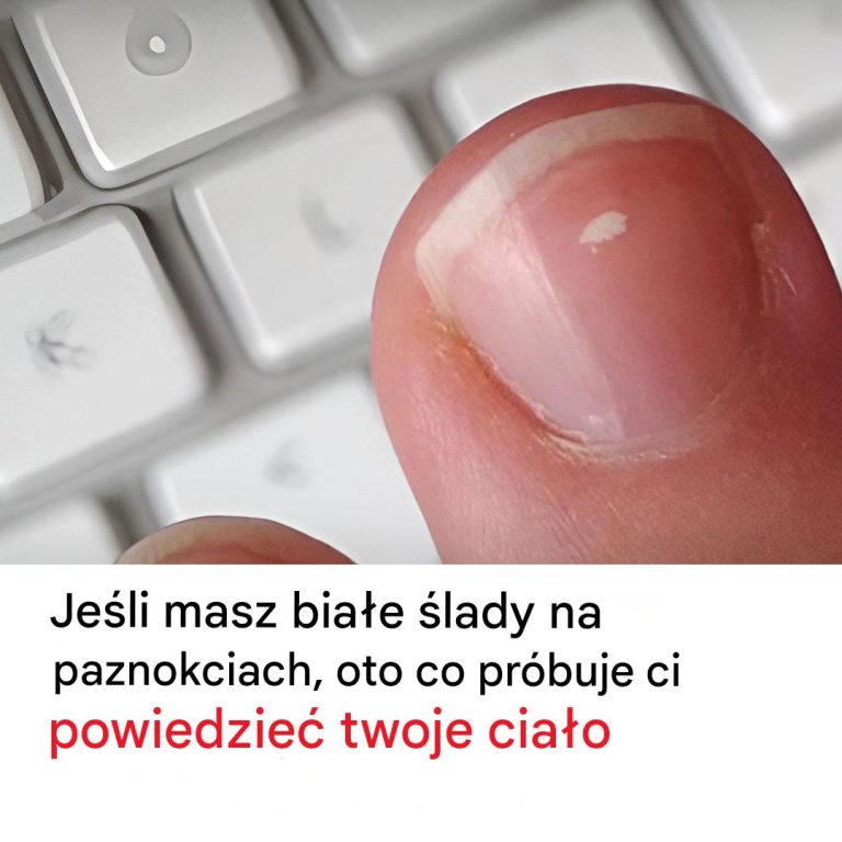 Białe Ślady na Paznokciach: Co Może Oznaczać?