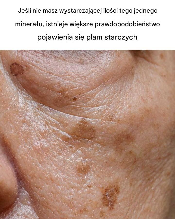 Dzisiaj dowiedziałem się czegoś nowego: moc selenu w zdrowiu skóry!