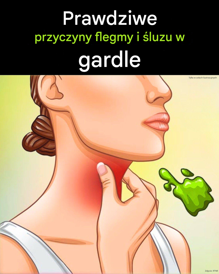 Prawdziwe przyczyny ciągłej flegmy i śluzu w gardle i jak się ich pozbyć
