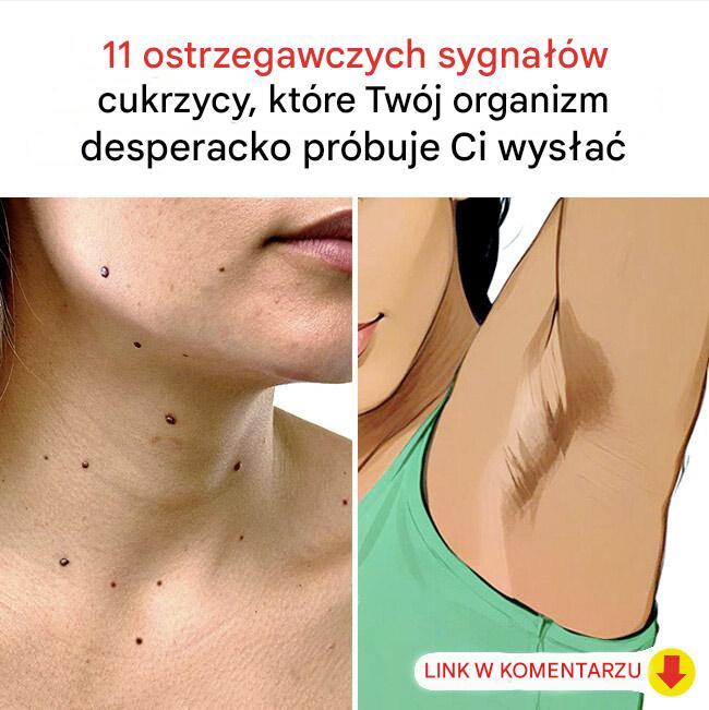 11 pomarańcza