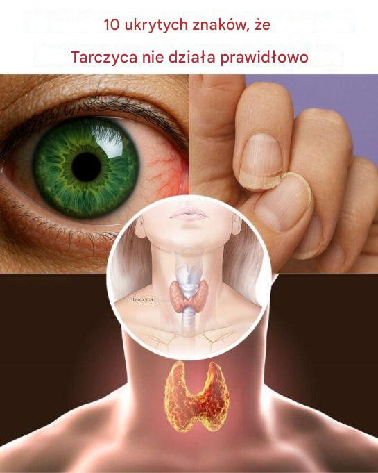 10 ukrytych oznak, że Twoja tarczyca nie działa prawidłowo