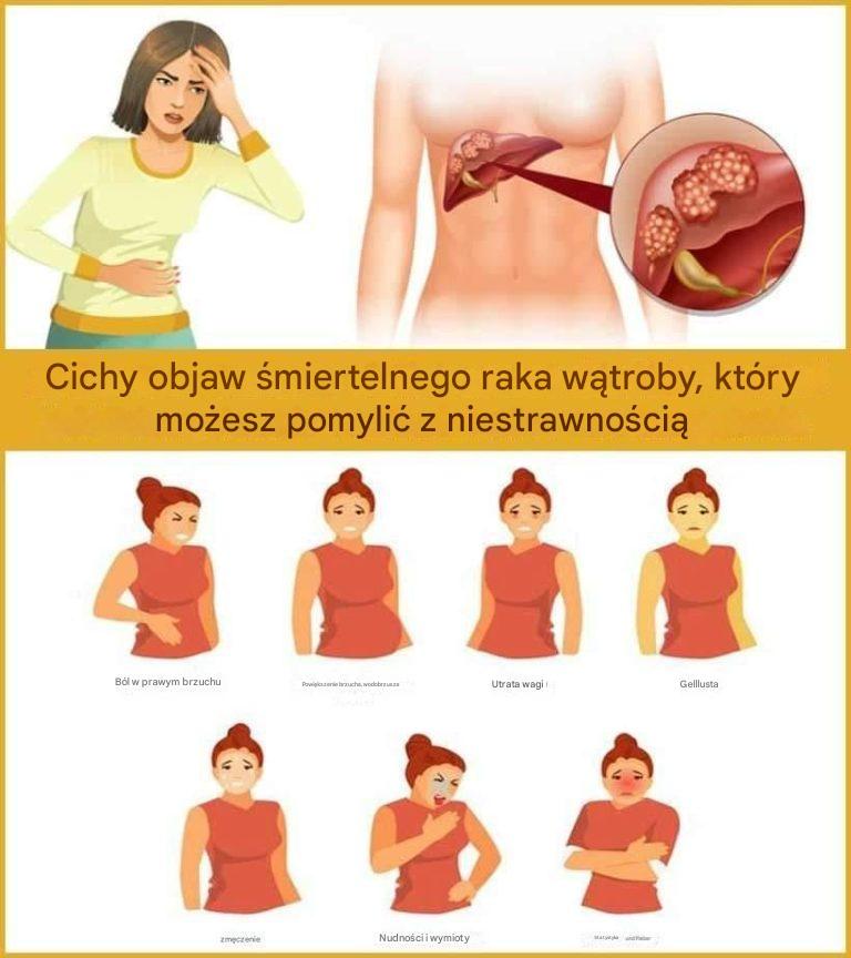 Cichy objaw śmiertelnego raka wątroby, który możesz pomylić z niestrawnością