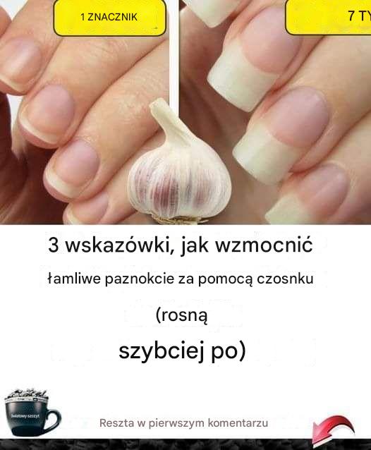 Mocne naturalne paznokcie: 3 wskazówki dotyczące czosnku dla szybkiego wzrostu i wzmocnienia