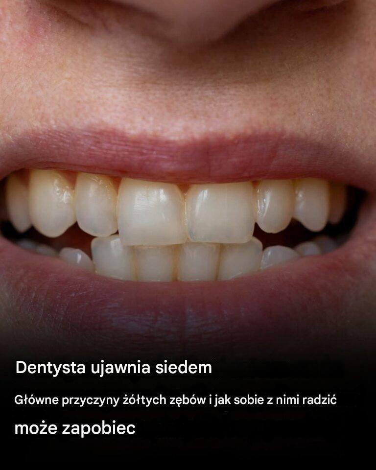 Dentysta wyjaśnia 7 głównych przyczyn żółknięcia zębów i jak temu zapobiegać