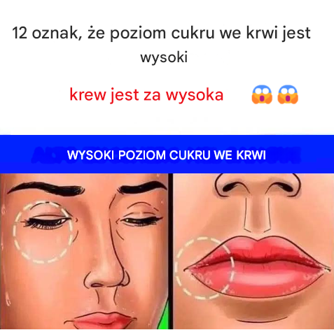 12 oznak, że poziom cukru we krwi jest zbyt wysoki